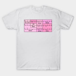 Hand Drawn Electrocardiogram (ECG) Pink T-Shirt